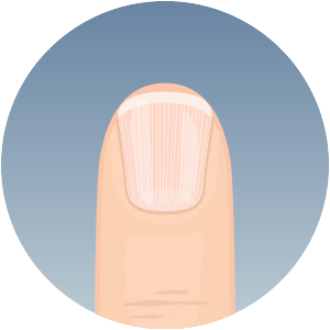 all-tenet-fingernails-clue-300x300-2024-02 Healthy fingernail appearance and nail structure
