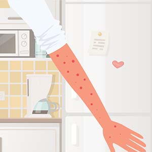 Severe allergic reactions